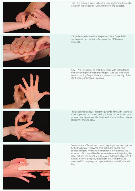 ulnar nerve compression test|will ulnar nerve heal itself.